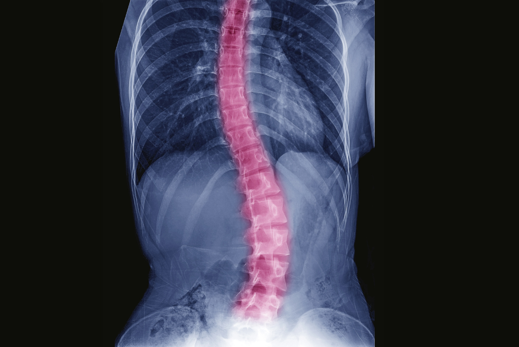 Spine Orthopaedic FRCS (Tr & Orth) revision course (On-demand videos | September—October 2022)