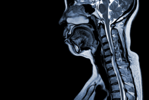 Virtual Spine Course for Allied Health Professional (On- demand videos | 5 February – 11 March 2024)